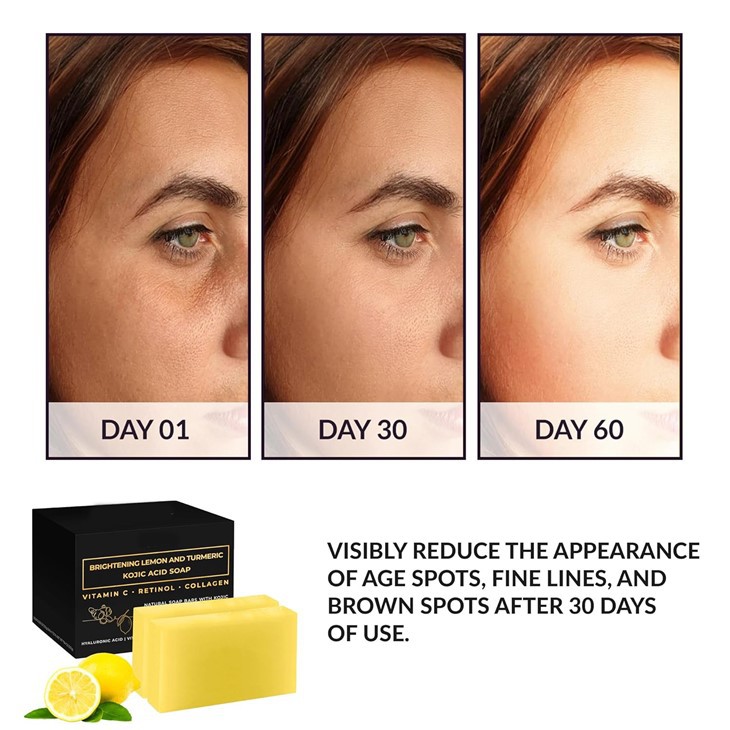 Lemon Turmeric And Kojic Acid Soap