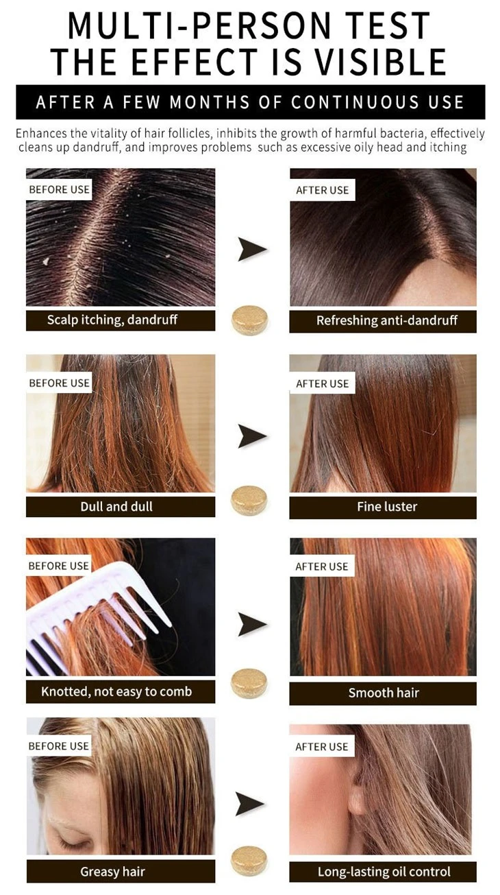 Rice Water Shampoo Bar For Hair Growth